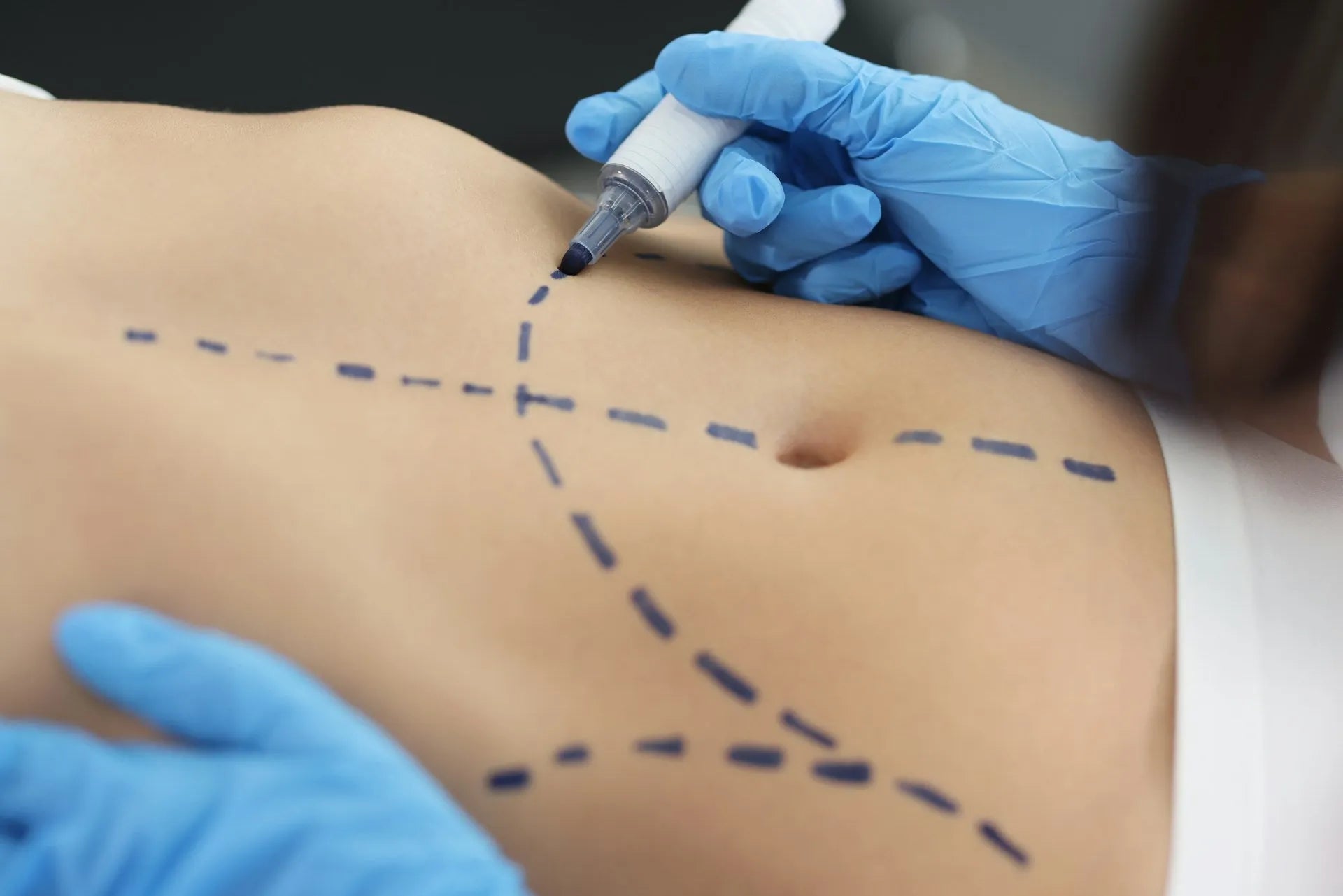 body contouring and sculpting
