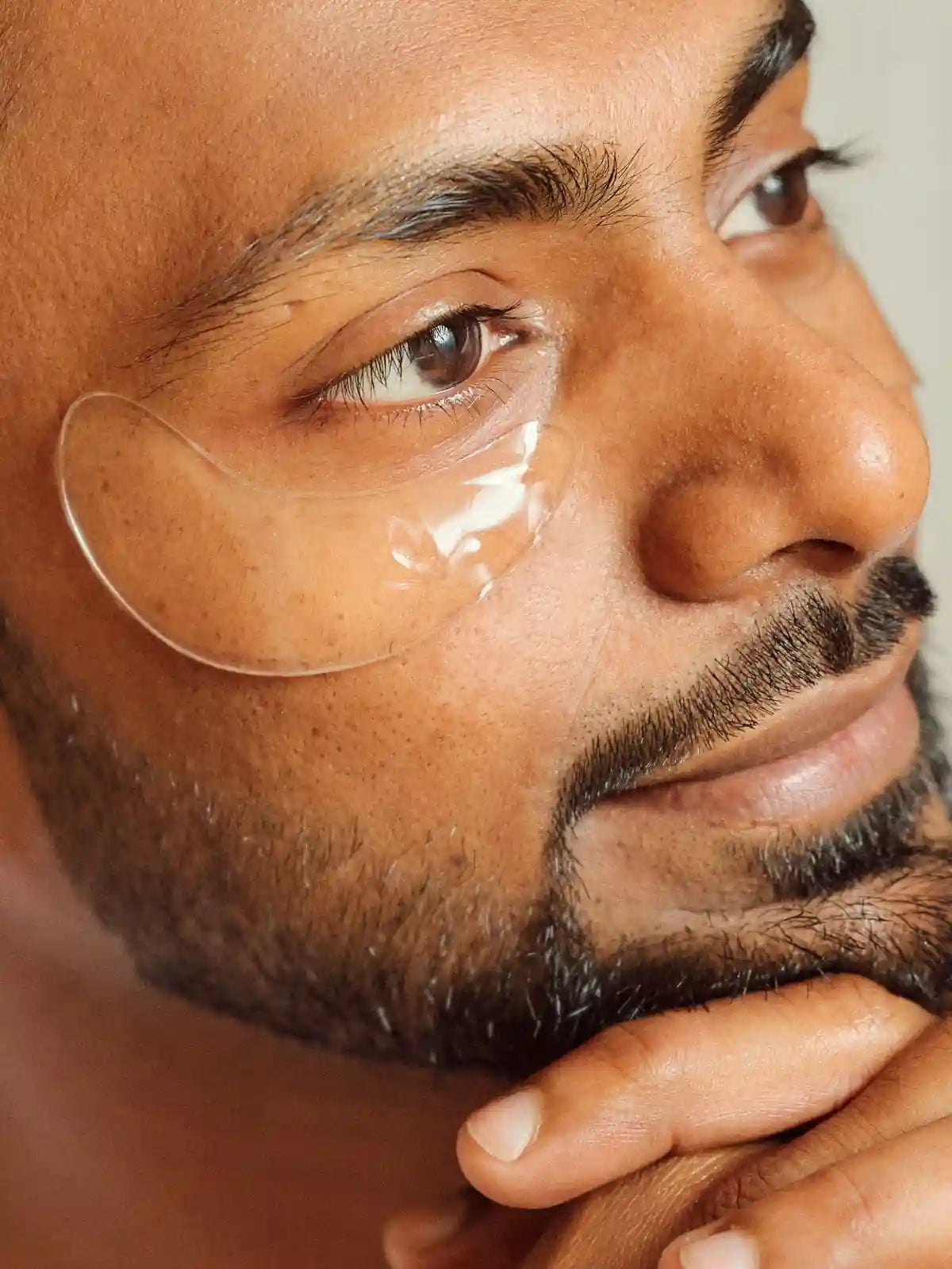 dark circles under eye concerns