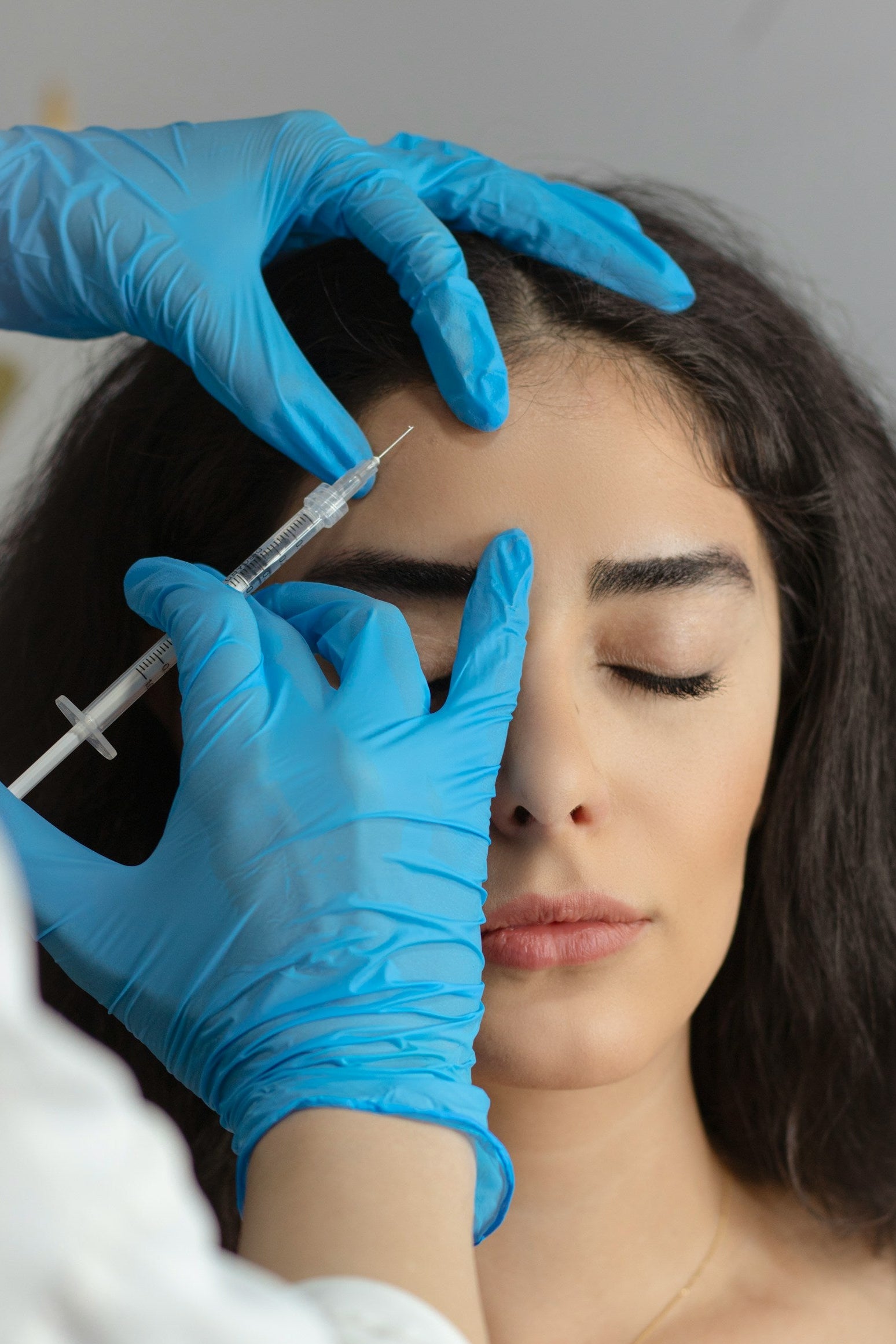dermal filler treatment